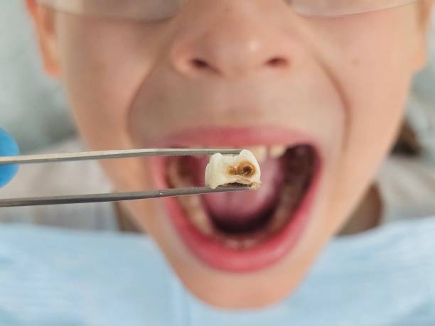 Best Same-Day Emergency Dentist in New Franklin, MO